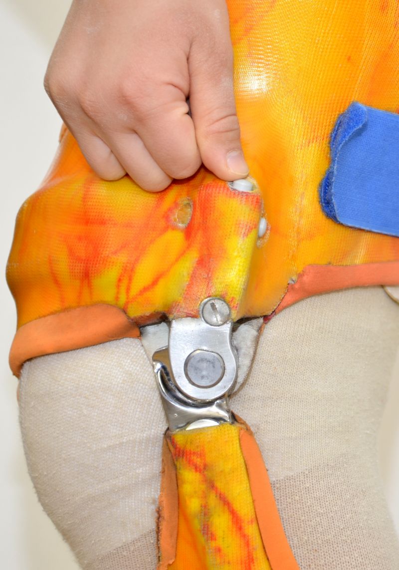 Salera preselect hip joint